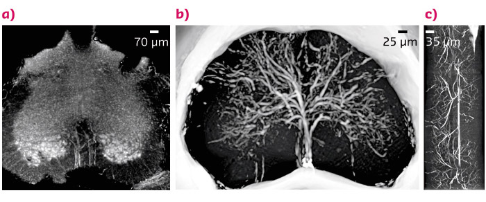 X-ray phase contrast microtomography