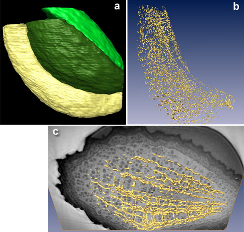 X-ray image of a seed with the seed-coat