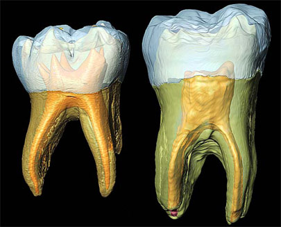 Neanderthal molars