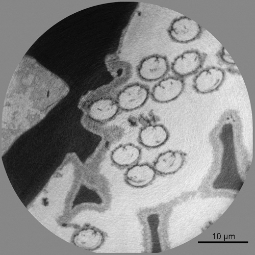 spermimage1 (500x500).jpg