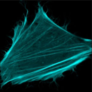 Fluorescence microscopy image showing the actin filaments in a living cell