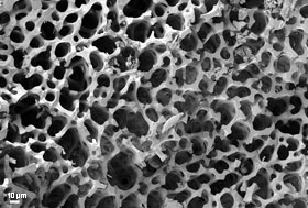 Scanning electron microscopy image of a section of sea urchin spine.