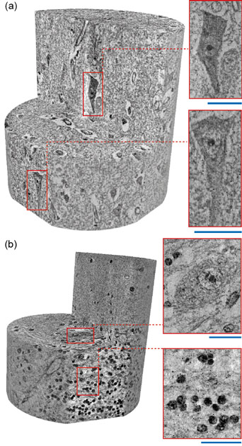 Three-dimensional imaging of the human neocortex