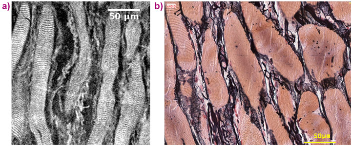 X-ray microtomographic image (voxel size 0.65 μm) of the left vocal muscle’s fibrous network