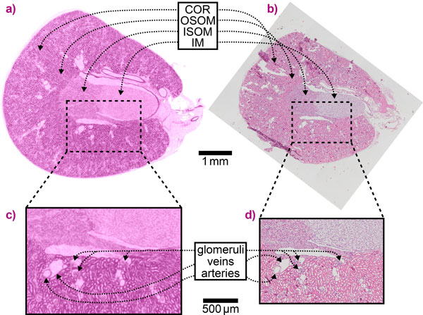 Comparison of virtual phase volume slices of a mouse kidney obtained with SBI and histological sections.