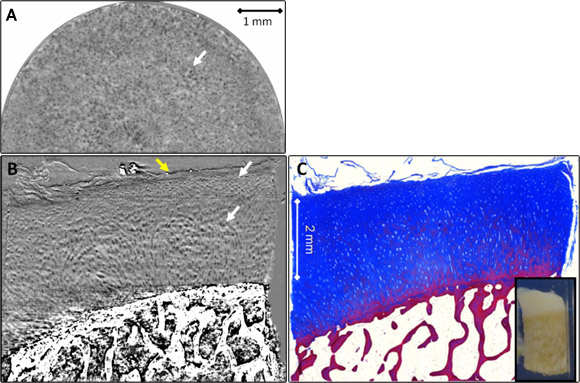 ABI-CT of normal cartilage