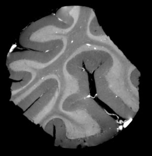 A single tomographic slice from the phase contrast tomography dataset
