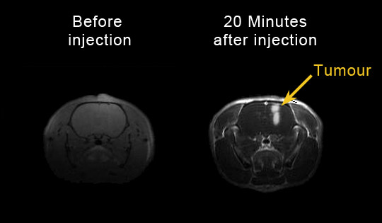 MRI images of rat brain glioma.