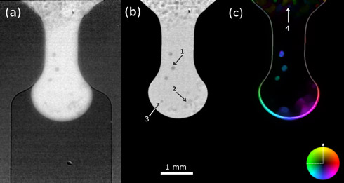 Radiograph from the bottleneck sequence