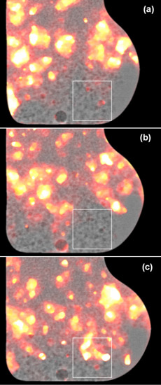 Spontaneous breakup of a large cluster of particles