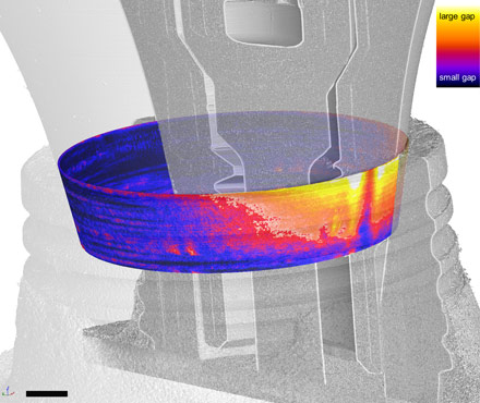 Microgap map (coloured) superimposed on the CT scan of the dental implant