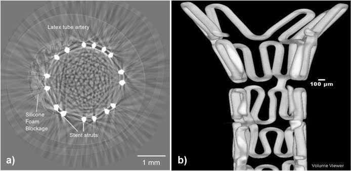 Tomography slice and re-constructed vertical section through part of a stent.